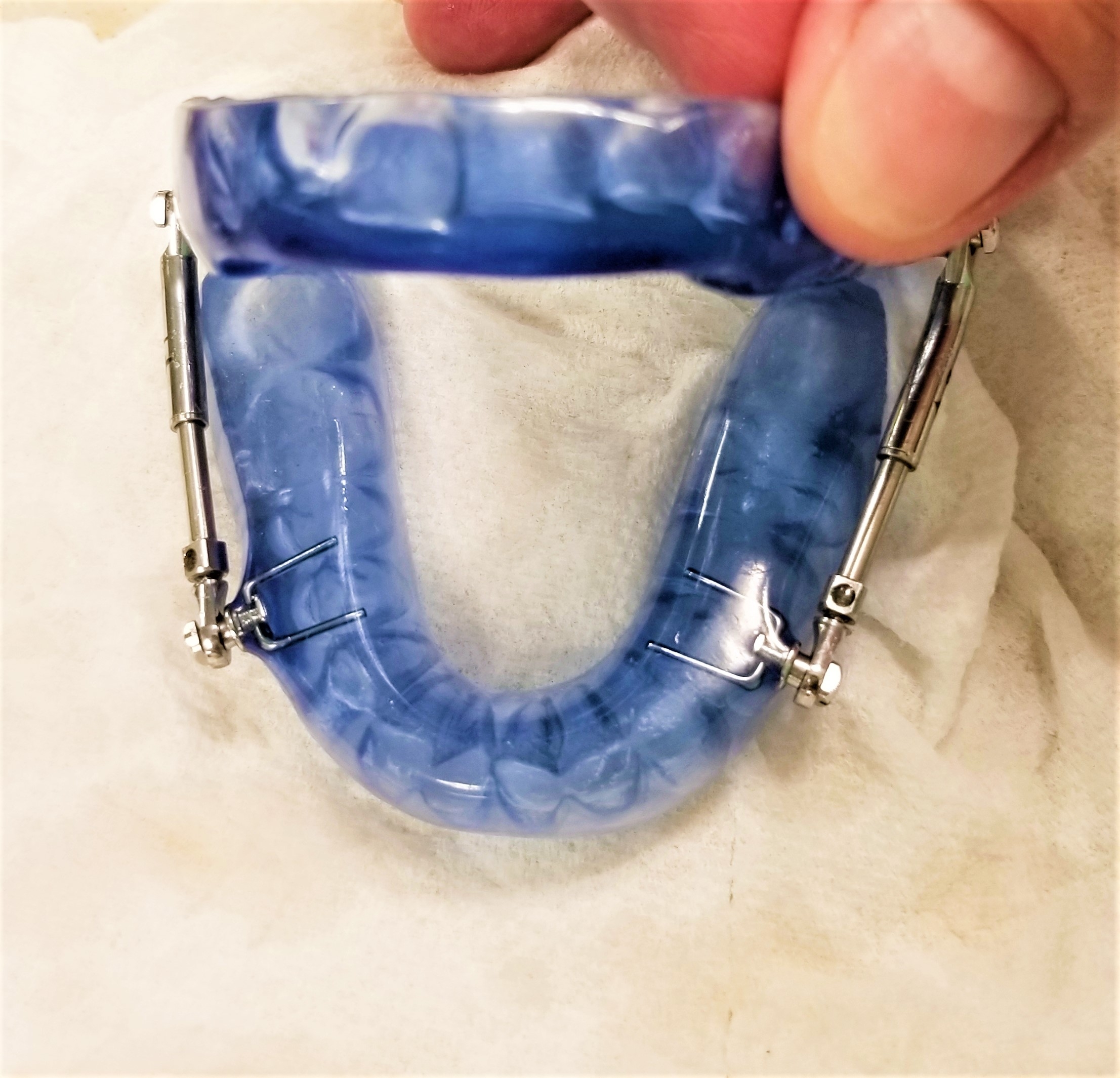 dental device for sleep apnea